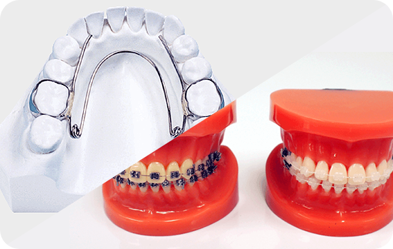 矯正装置の装着