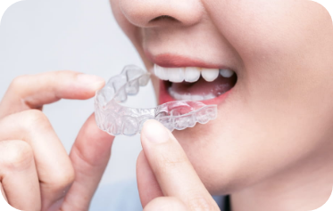 マウスピース矯正