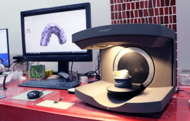 当院のインプラントの品質